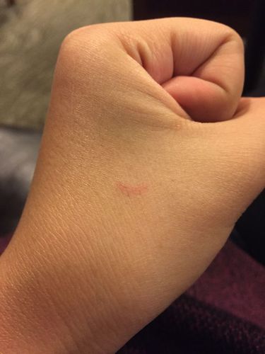 被猫抓伤出血要打针吗,被猫抓伤出血要打针吗伤口很小,被家猫抓伤轻微出血要打针吗？
